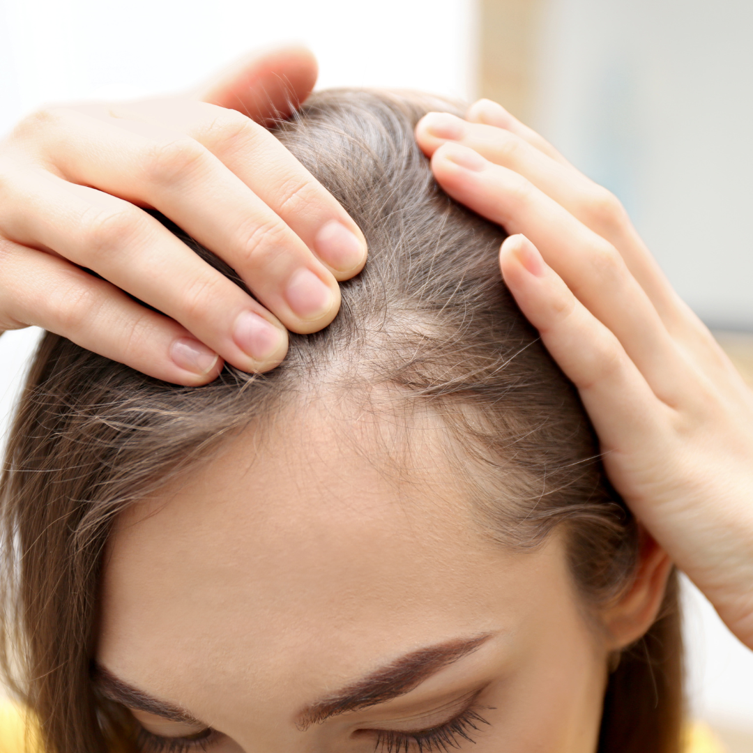 PRP For Hair Loss